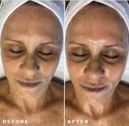 Aquafirme BOGO promotion