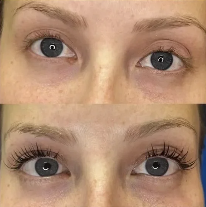 Lash Lift Treatment